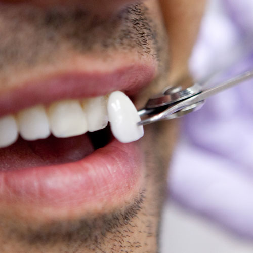 Odontología Estética